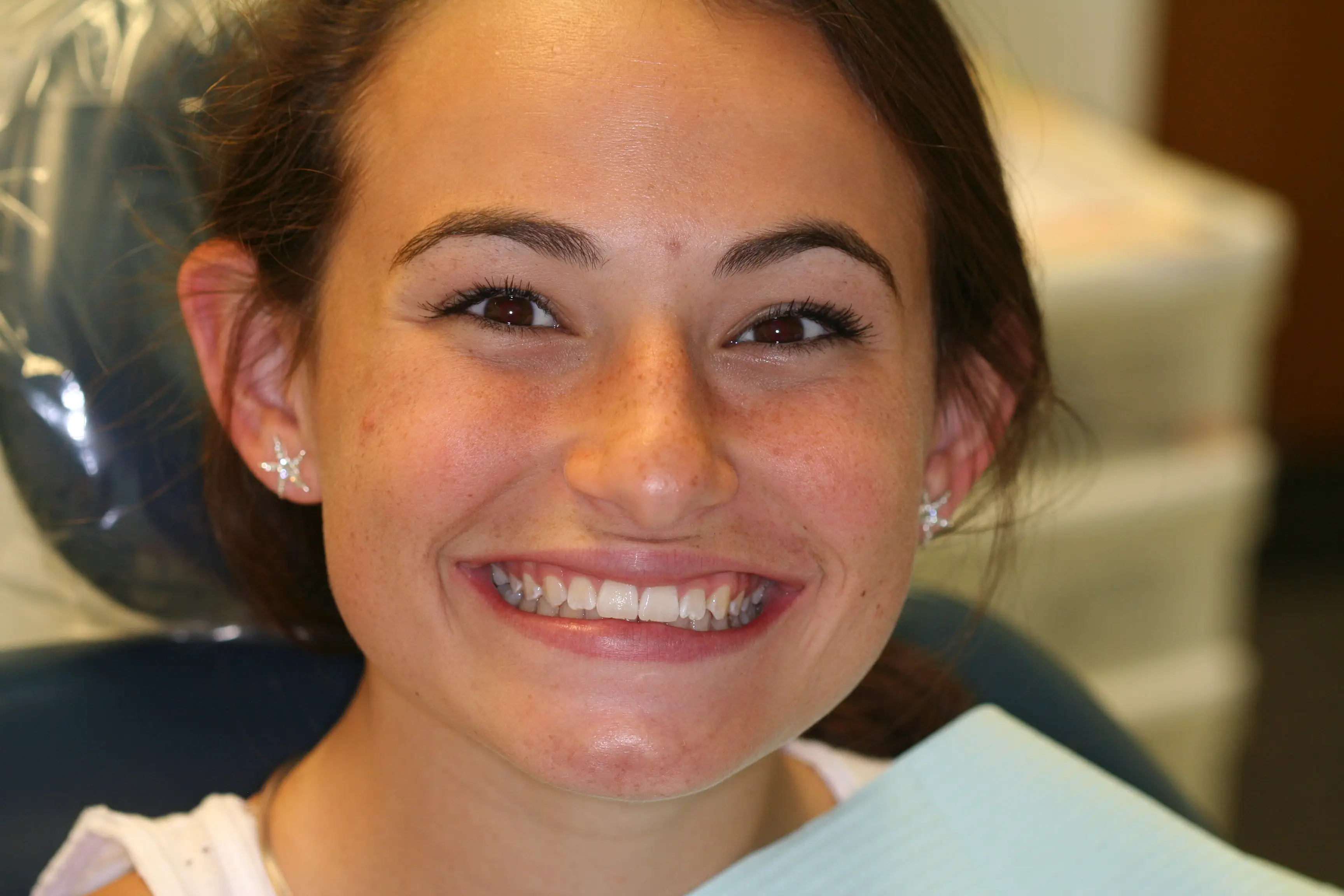 Invisalign After